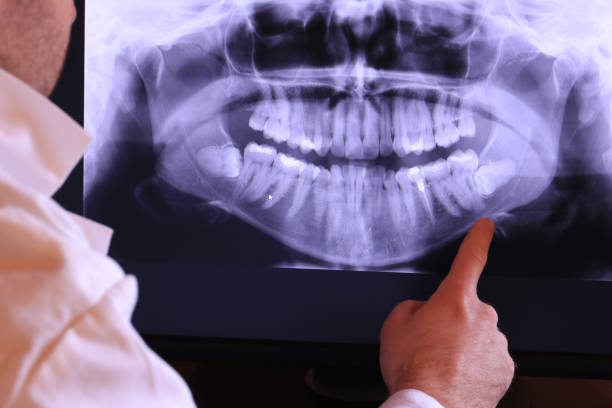 Best Chipped Tooth Repair Near Me  in Central Falls, RI